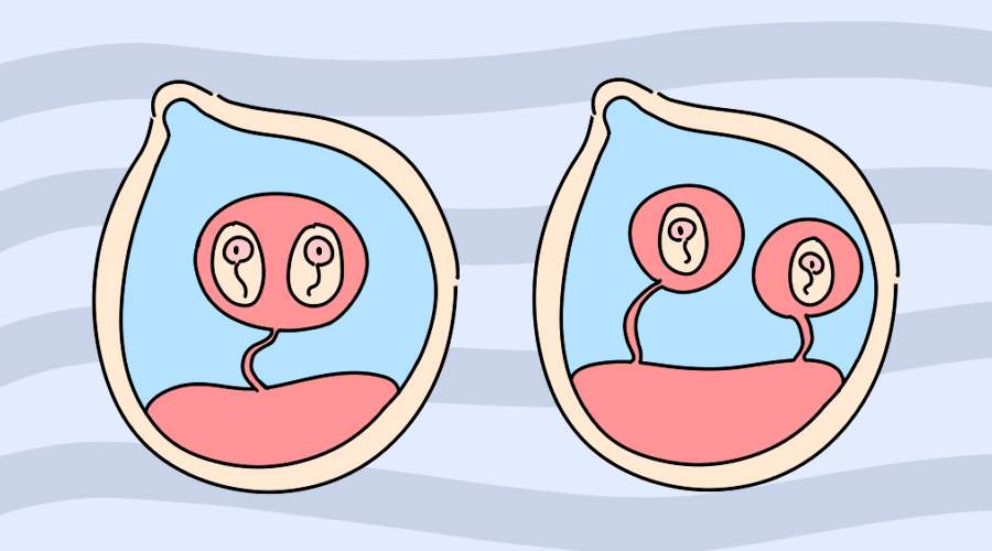 子宫小做试管双胞胎的成活率高吗？